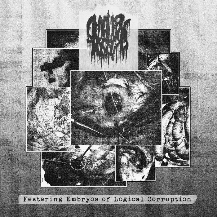 Smallpox Aroma - Festering Embryos of Logical Corruption CD