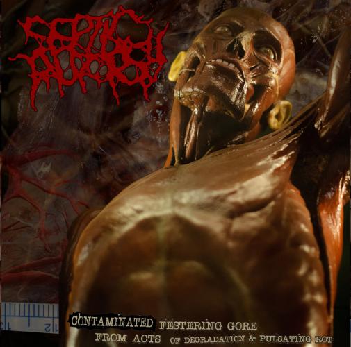 Septic Autopsy - Contaminated Festering Gore from Acts of Degradation & Pulsating Rot CD